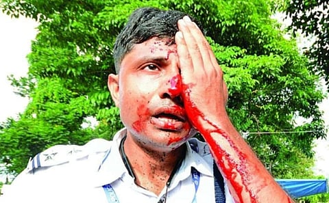 प्रदर्शनकारियों के पत्थराव में सार्जेंट देवाशिष चक्रवर्ती की आंख में लगी चोट, लगातार बहता रहा खून….