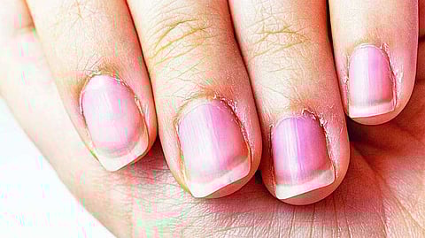 अपने नाखूनों के रंग और आकार से जानें अपना स्वास्थ्य