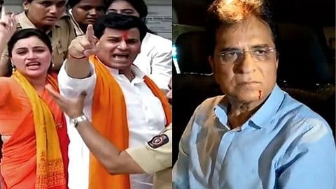 शिवसेनेने पुन्हा डिवचले; रक्ताऐवजी धमन्यांत टोमॅटो सॉस भरला की....