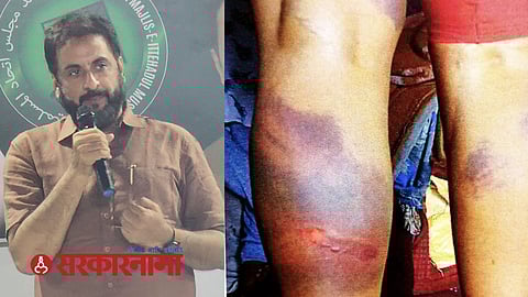 AIMIM March Against Police News