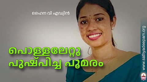 പൊള്ളലേറ്റു പുഷ്പിച്ച പൂമരം