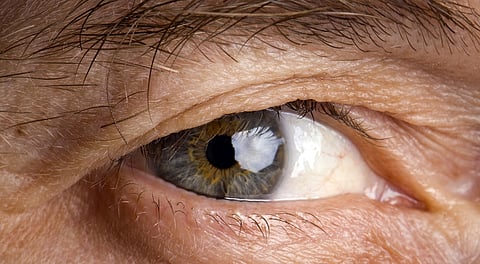 Those above 40 must test for glaucoma: Experts
