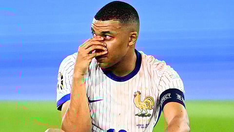 Euro 2024: Kylian Mbappe may miss remaining Group Stage games after breaking his Nose