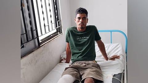 Assam: Robber Magrav Ali injured in police encounter in Barpeta