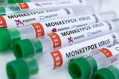 Mpox case