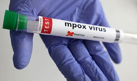 Mpox virus