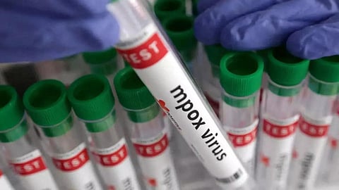 Mpox case in kerala