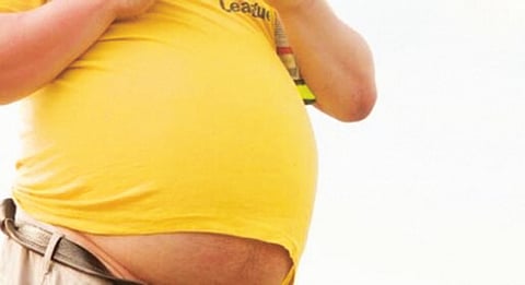 Obesity