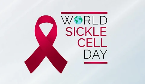 World Sickle Cell Day