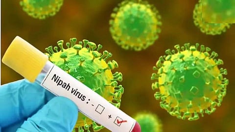 Nipah virus