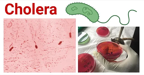 cholera