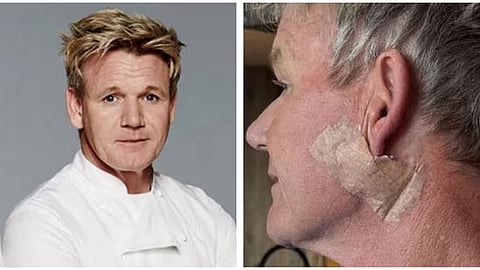 Gordon Ramsay