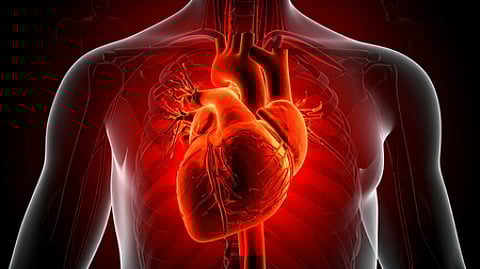 heart attack