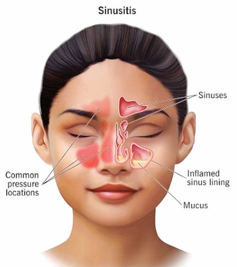 sinus