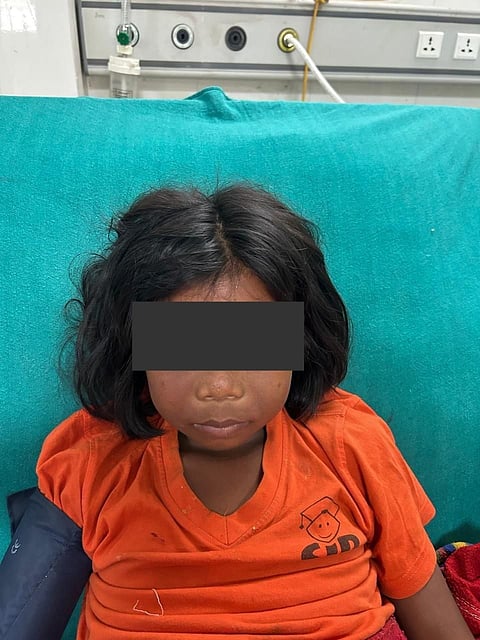 The photograph of the snakebite victim with a drastically swollen face following the attack