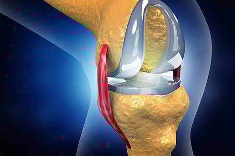 Guwahati Knee Symposium