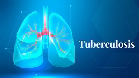 TB treatment