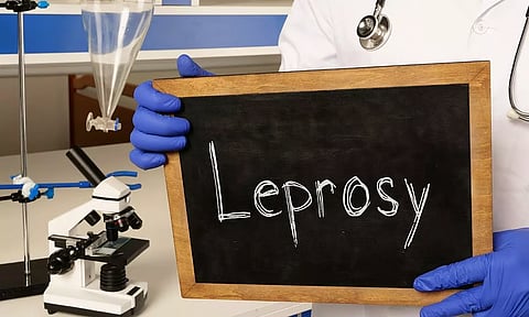 leprosy