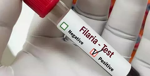 Mass Drug Administration