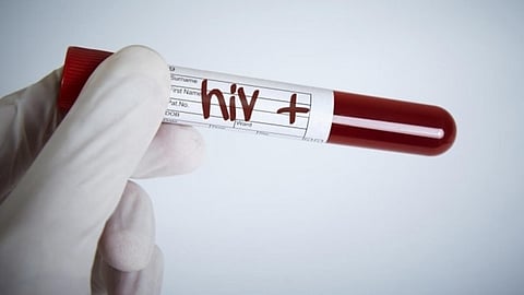 Highest HIV cases in Meghalaya; over 10,000 people getting treatment