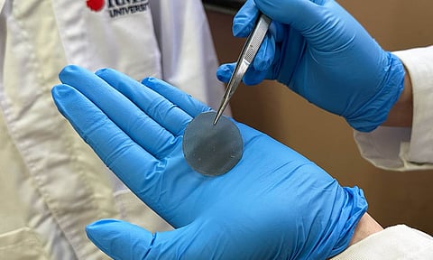 Smart wound dressing