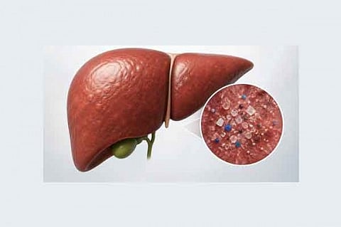 liver disease