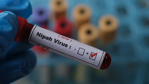 Nipah virus