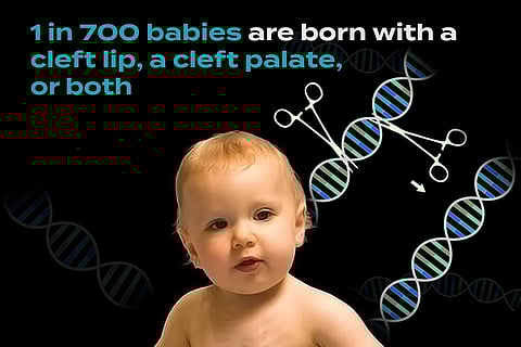 CRISPR: Giving Cleft Lip & Palate a Facelift