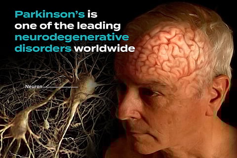 Parkinson’s Disease: A Dopamine-Depleting Neurodegenerative Disorder