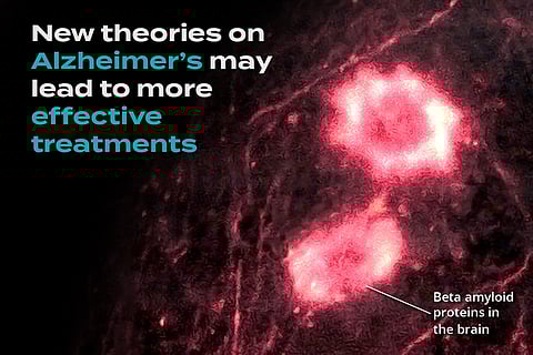 Promising New Therapies for Alzheimer's Disease