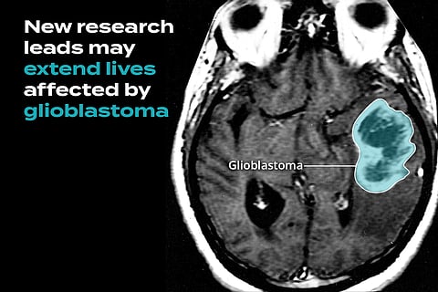 Hunting Down "The Terminator", the Deadliest Brain Cancer Around