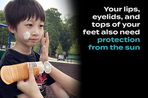 What Can We Learn from the Aussies About Protecting our Skin from the Sun?