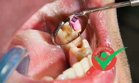 Can A root canal treatment cause cancer? Explained
