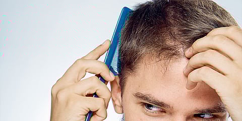 50 per cent Indian men below 25 falling prey to hair loss: Study