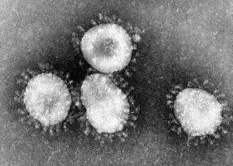 DON'T PANIC: NOVEL CORONAVIRUS INFECTION IS LOW RISK TO OUR COMMUNITY