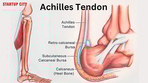 Achilles Tendon