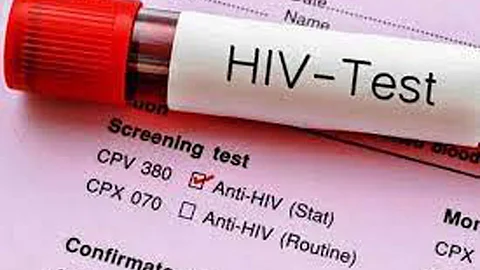Owwa eyes inclusion of HIV in pre-departure seminar
