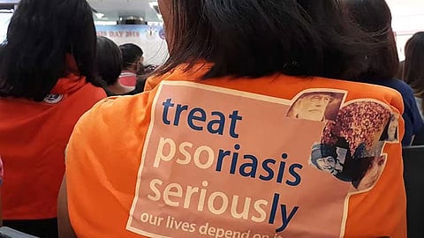 Psoriasis not contagious, must not cause stigma