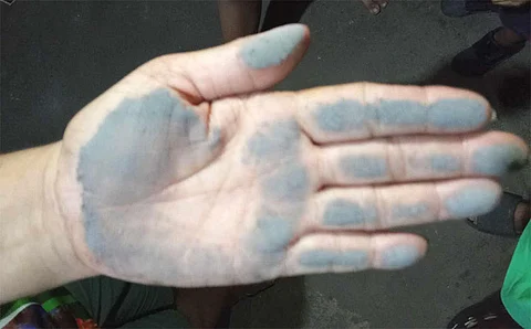 NEGROS. Following the 5,000-meter phreatic eruption at Mt. Kanlaon Monday night, June 3, 2024, ashfall was reported in Manghanoy, La Castellana in Negros Occidental.