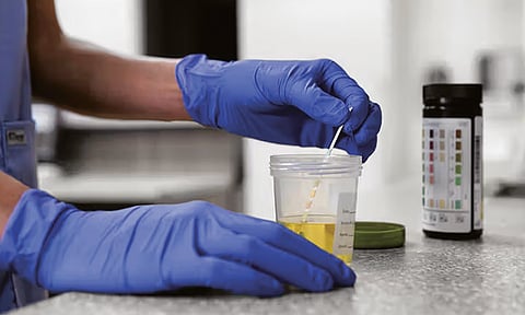 PDEA: Drug testing in schools must follow national guidelines