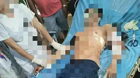 ZAMBOANGA. A member of the Philippine Coast Guard, Nurhan Birong, expires while under medical treatment at a hospital in Zamboanga City on Friday, June 21. Birong was repeatedly shot while his girlfriend was unscathed in a gun attack on Thursday, June 20, in Sitio Calle Onse, Maligaya village, Lamitan City, Basilan.