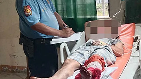 Drayber sa traysikol naigo sa saag nga bala