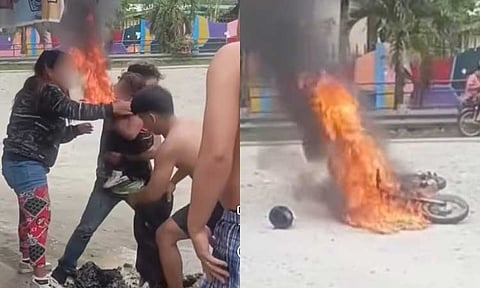 A two-year-old girl sustained second-degree burns on her face and body after her family's motorcycle caught fire in New Bataan, Davao de Oro, on Thursday afternoon, January 2, 2025.