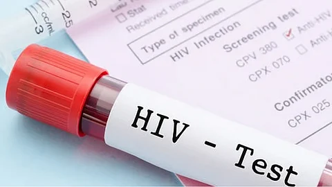 117 kaso sa HIV natala sa Davao