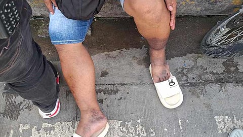 Magtiayon gidumbolan sa laing motor, nangaangol