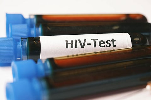 HIV test
