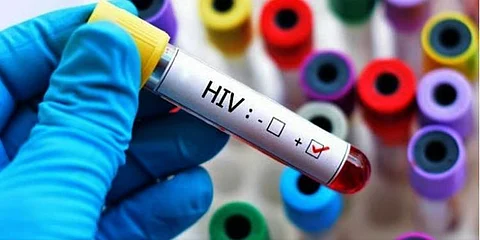 Davao Region ika-4 sa nay taas nga kaso sa HIV
