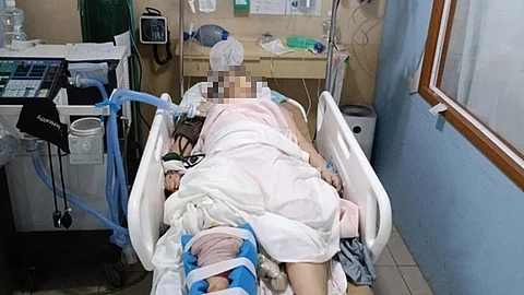 Motorcycle driver, woman in critical condition after road accident