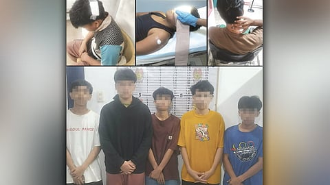 3 ka dancer sa Sinulog gipangkulata