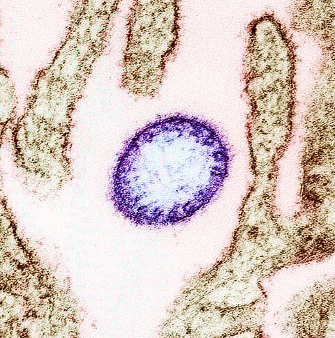 Nipah virus.